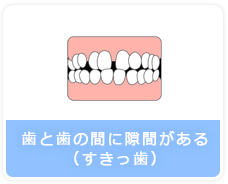 歯と歯の間に隙間がある（すきっ歯）